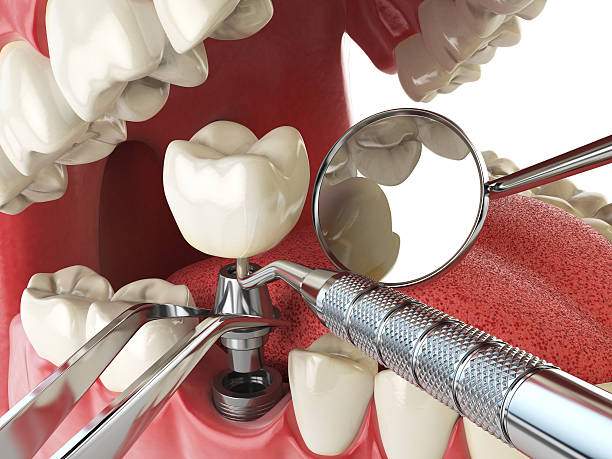 Best Emergency Root Canal Therapy in Tonopah, NV
